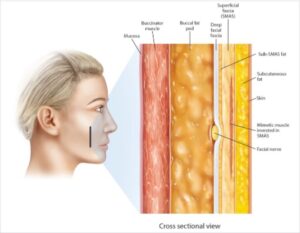 Facial Fascia Its Effects On Appearance And Function Facial