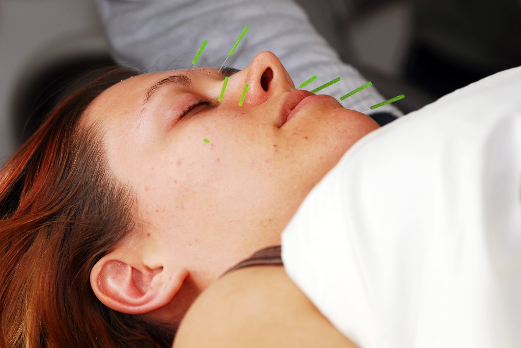 Facial Rejuvenation Cosmetic Acupucture Training Classes