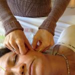 Acupuncture Treatment for Facial Pain and Paralysis