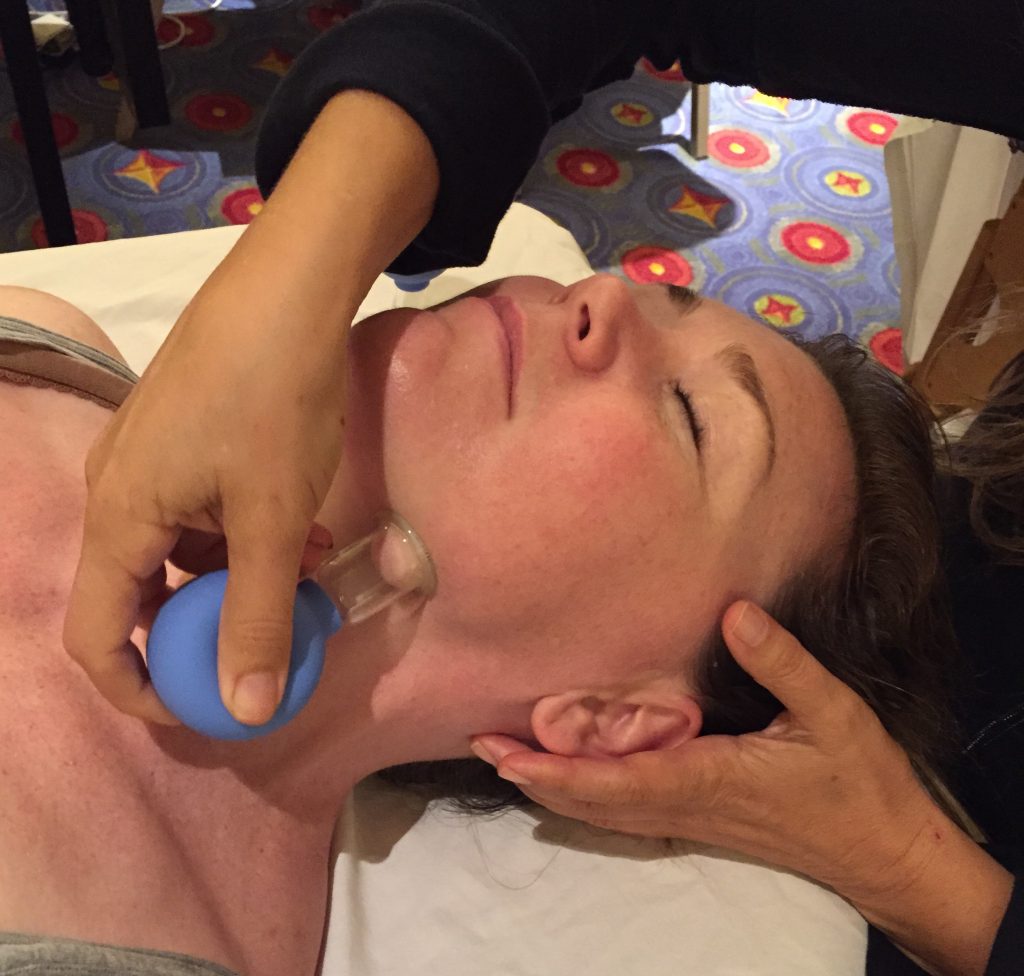 Gellis Facial Cupping Cosmetic Acupuncture Training CEU