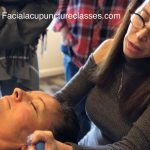 michelle gellis teaches facial acupuncture