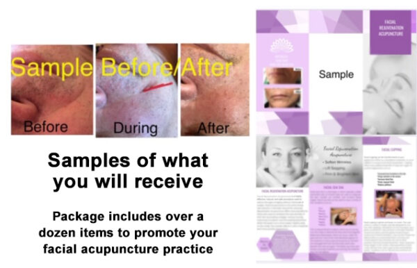 Cosmetic Acupuncture Marketing Materials