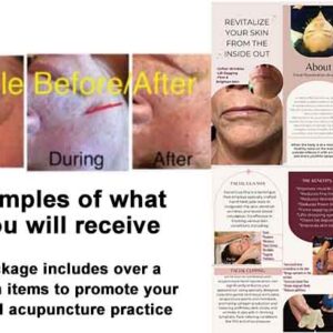 Sample of items included in the Gellis Acupuncture Marketing Package