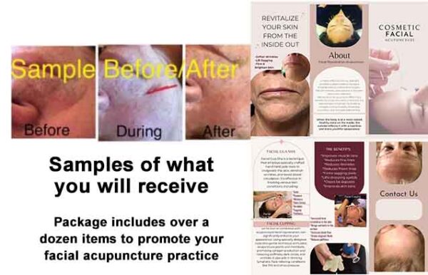 Sample of items included in the Gellis Acupuncture Marketing Package