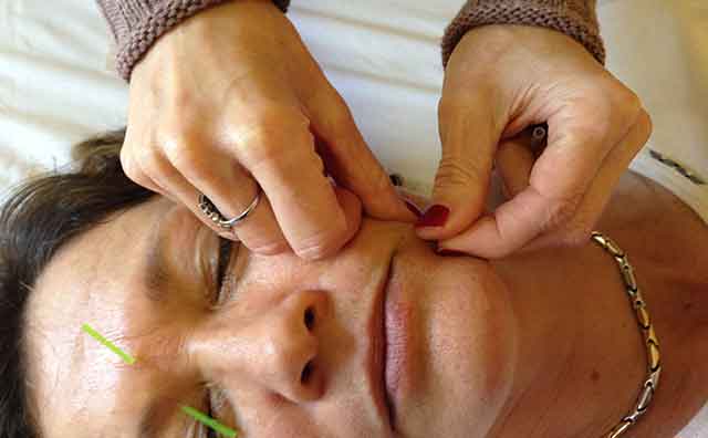 michelle gellis facial acupuncture classes treats mouth area