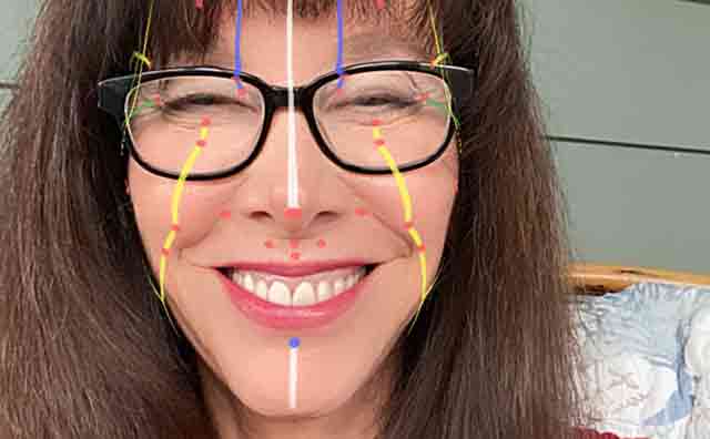 Michelle Gellis reviews the Anatomy of Expression related to Facial Acupuncture