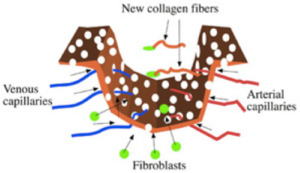 microneedling collagen michelle gellis facial acupuncture classes