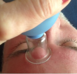 aculift facial cups